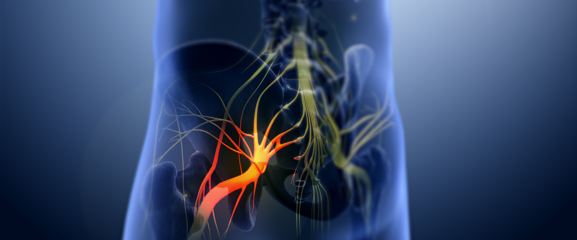 Does thc help with sciatic nerve pain?