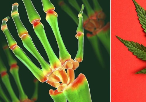 Does thc help pain?